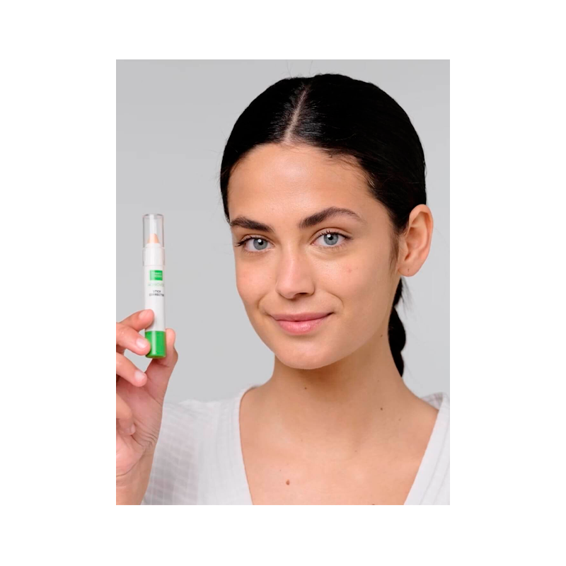 Martiderm Acniover Stick 15g