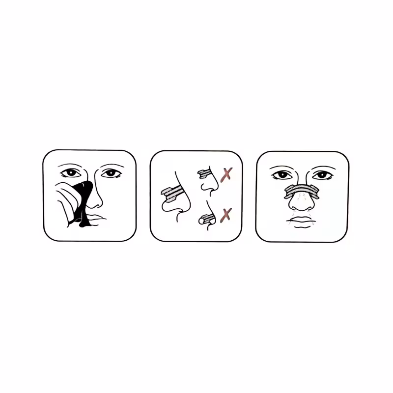 RinoFlux Strip Penso Nasal Standard 5,6x1,8cm 10 unidades